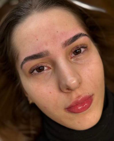 Hydralips result